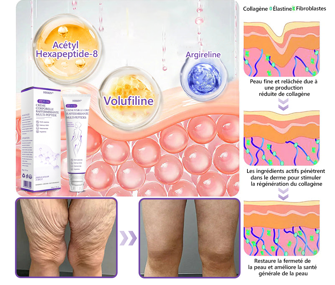 HISKIN® Crème corps roller PDRN Multi-Peptides 🌹— anti-âge, hydratante, raffermissante, effet liftant, aide à réparer la peau, unifier le teint, cibler boutons, taches, verrues, grains de beauté et psoriasis.