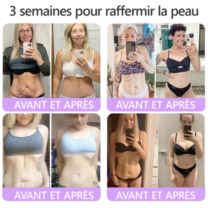 HISKIN® Crème corps roller PDRN Multi-Peptides 🌹— anti-âge, hydratante, raffermissante, effet liftant, aide à réparer la peau, unifier le teint, cibler boutons, taches, verrues, grains de beauté et psoriasis.