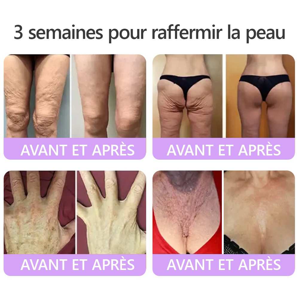 HISKIN® Crème corps roller PDRN Multi-Peptides 🌹— anti-âge, hydratante, raffermissante, effet liftant, aide à réparer la peau, unifier le teint, cibler boutons, taches, verrues, grains de beauté et psoriasis.