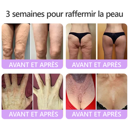 HISKIN® Crème corps roller PDRN Multi-Peptides 🌹— anti-âge, hydratante, raffermissante, effet liftant, aide à réparer la peau, unifier le teint, cibler boutons, taches, verrues, grains de beauté et psoriasis.