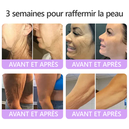 HISKIN® Crème corps roller PDRN Multi-Peptides 🌹— anti-âge, hydratante, raffermissante, effet liftant, aide à réparer la peau, unifier le teint, cibler boutons, taches, verrues, grains de beauté et psoriasis.