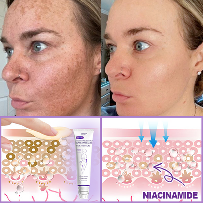 HISKIN® Crème corps roller PDRN Multi-Peptides 🌹— anti-âge, hydratante, raffermissante, effet liftant, aide à réparer la peau, unifier le teint, cibler boutons, taches, verrues, grains de beauté et psoriasis.