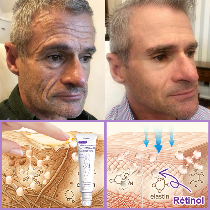 HISKIN® Crème corps roller PDRN Multi-Peptides 🌹— anti-âge, hydratante, raffermissante, effet liftant, aide à réparer la peau, unifier le teint, cibler boutons, taches, verrues, grains de beauté et psoriasis.