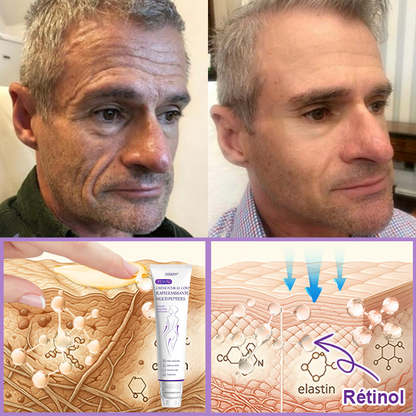 HISKIN® Crème corps roller PDRN Multi-Peptides 🌹— anti-âge, hydratante, raffermissante, effet liftant, aide à réparer la peau, unifier le teint, cibler boutons, taches, verrues, grains de beauté et psoriasis.